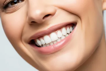 Diş Beyazlatma (Bleaching)